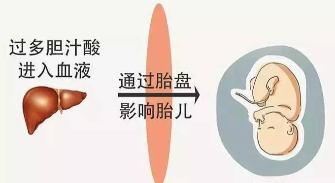 9fc14c74d93ce834fa4d4825c8a72ed.png